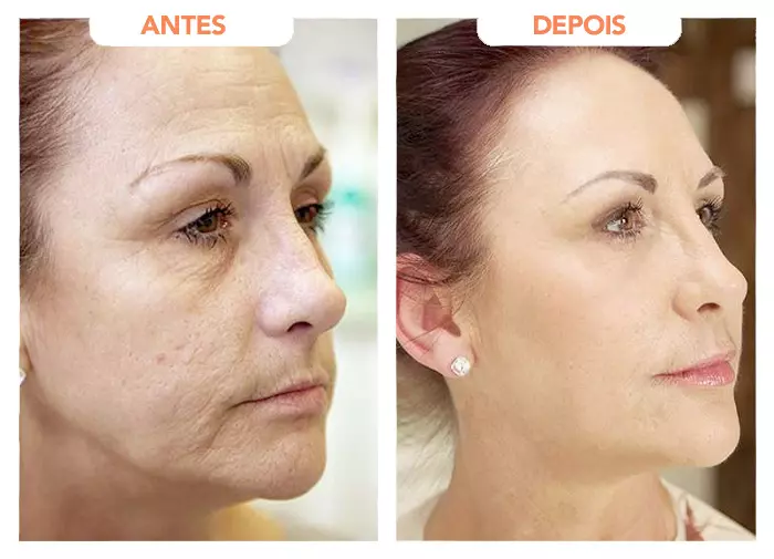 AnyConv.com__resultado-01-1